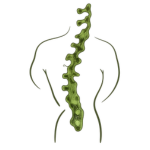 Back Pain / Sciatica